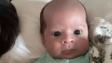 Photo of Calvo de nacimiento, bebe conquista a los internautas